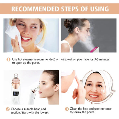 Electric Blackhead Remover and Facial Cleanser - ClearSkin Pro-Nora Luxe