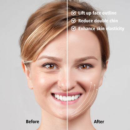 EMS FACE LIFT WITH LED THERAPY - SLIMMER FACE AND DOUBLE CHIN REMOVAL-White-Nora Luxe